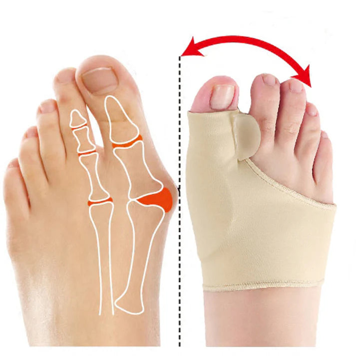 Corrector de Juanetes - transforma tu caminar y alivia el dolor 2x1
